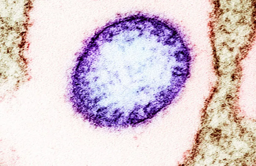 virusi nipah laborator