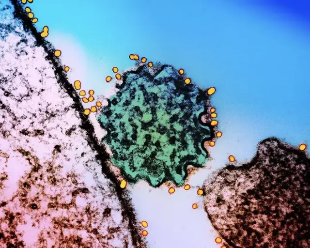 virusi-nipah-mikroskop-obsh
